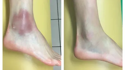 Praktyka Fizjoterapii i Osteopatii Dr Ewa Żeligowska